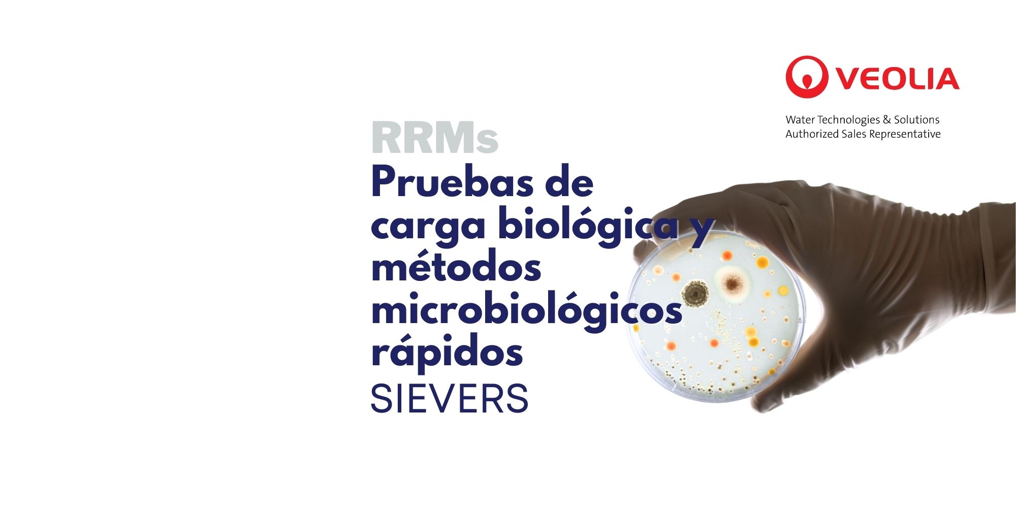 Pruebas de carga biológica y métodos rápidos de microbiología